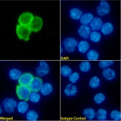 Invitrogen&trade;&nbsp;CD25 Chimeric Recombinant Rabbit Monoclonal Antibody (7D4)