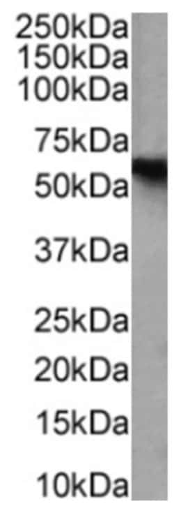 Invitrogen CD25 Chimeric Recombinant Rabbit Monoclonal Antibody (7D4) 200 &mu;g | Buy Online | Invitrogen&trade; | Fisher Scientific