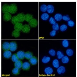 Invitrogen&trade;&nbsp;S100A9 Recombinant Mouse Monoclonal Antibody (IID4B10)