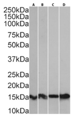 Invitrogen S100A9 Recombinant Mouse Monoclonal Antibody (IID4B10) 200 &mu;g | Buy Online | Invitrogen&trade; | Fisher Scientific