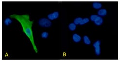 Invitrogen Protein C Recombinant Mouse Monoclonal Antibody (HPC-4) 200