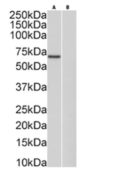 Invitrogen Protein C Recombinant Mouse Monoclonal Antibody (HPC-4) 200