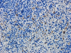 Invitrogen CD19 Recombinant Mouse Monoclonal Antibody (FMC63) 200 &mu;g;
