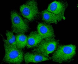 Invitrogen&trade;&nbsp;PTEN Recombinant Rabbit Monoclonal Antibody (SJ19-03)