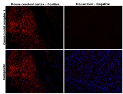 Invitrogen&trade;&nbsp;Cannabinoid Receptor 1 Recombinant Rabbit Monoclonal Antibody (PSH02-43)