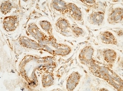 Invitrogen LAMP1 Monoclonal Antibody (07), Invitrogen 20 &mu;L; Unconjugated:Antikörper