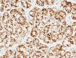 Carbonic Anhydrase IX Recombinant Rabbit Monoclonal Antibody (005), Invitrogen:Antikörper:Primärantikörper