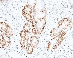 Carbonic Anhydrase IX Recombinant Rabbit Monoclonal Antibody (005), Invitrogen:Antikörper:Primärantikörper