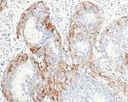 Carbonic Anhydrase IX Recombinant Rabbit Monoclonal Antibody (005), Invitrogen:Antikörper:Primärantikörper