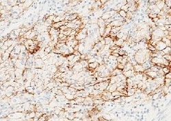 Carbonic Anhydrase IX Recombinant Rabbit Monoclonal Antibody (005), Invitrogen:Antikörper:Primärantikörper