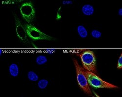 Invitrogen RAB1A Recombinant Rabbit Monoclonal Antibody (PSH03-62) 100
