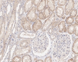 Invitrogen RAB1A Recombinant Rabbit Monoclonal Antibody (PSH03-62) 100