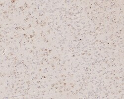 Invitrogen RAB1A Recombinant Rabbit Monoclonal Antibody (PSH03-62) 100