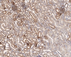 Invitrogen RAB1A Recombinant Rabbit Monoclonal Antibody (PSH03-62) 100