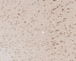 Invitrogen RAB1A Recombinant Rabbit Monoclonal Antibody (PSH03-62) 100