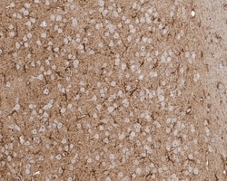 Invitrogen Aldolase C Recombinant Rabbit Monoclonal Antibody (PSH01-82)