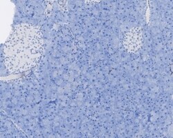 Invitrogen Aldolase C Recombinant Rabbit Monoclonal Antibody (PSH01-82)