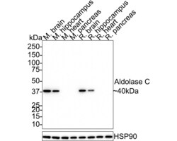 Invitrogen Aldolase C Recombinant Rabbit Monoclonal Antibody (PSH01-82)