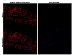 Invitrogen MUSK Recombinant Rabbit Monoclonal Antibody (PSH05-68) 100 &mu;L;