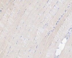 Invitrogen MUSK Recombinant Rabbit Monoclonal Antibody (PSH05-68) 100 &mu;L;