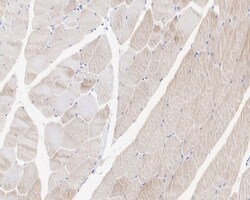 Invitrogen MUSK Recombinant Rabbit Monoclonal Antibody (PSH05-68) 100 &mu;L;