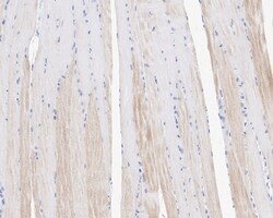 Invitrogen MUSK Recombinant Rabbit Monoclonal Antibody (PSH05-68) 100 &mu;L;