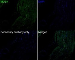 Invitrogen MUSK Recombinant Rabbit Monoclonal Antibody (PSH05-68) 100 &mu;L;