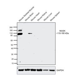 Invitrogen MUSK Recombinant Rabbit Monoclonal Antibody (PSH05-68) 100 &mu;L;