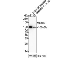 Invitrogen MUSK Recombinant Rabbit Monoclonal Antibody (PSH05-68) 100 &mu;L;