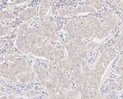 Invitrogen XIAP Recombinant Rabbit Monoclonal Antibody (PSH04-30) 100 &mu;L;