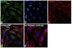 Invitrogen EIF2S1 Recombinant Rabbit Monoclonal Antibody (PSH04-29) 100