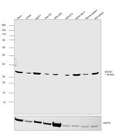 Invitrogen EIF2S1 Recombinant Rabbit Monoclonal Antibody (PSH04-29) 100