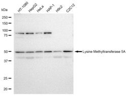 Invitrogen SETD8 Recombinant Rabbit Monoclonal Antibody (23GB2840) 20 &mu;L | Buy Online | Invitrogen&trade; | Fisher Scientific