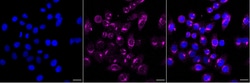 Invitrogen CHM Recombinant Rabbit Monoclonal Antibody (23GB3065) 20 &mu;L | Buy Online | Invitrogen&trade; | Fisher Scientific