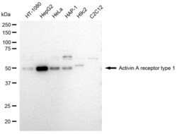 Invitrogen ACVR1 Recombinant Rabbit Monoclonal Antibody (23GB3630), Invitrogen