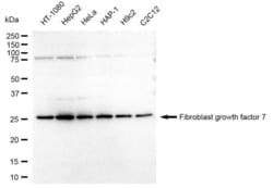 Invitrogen KGF Recombinant Rabbit Monoclonal Antibody (23GB3840), Invitrogen