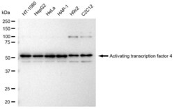 Invitrogen ATF4 Recombinant Rabbit Monoclonal Antibody (23GB3140), Invitrogen