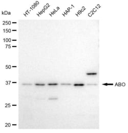 Invitrogen ABO Recombinant Rabbit Monoclonal Antibody (23GB3610), Invitrogen