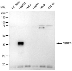 Invitrogen C4BPB Recombinant Rabbit Monoclonal Antibody (23GB3715) 20 &mu;L | Buy Online | Invitrogen&trade; | Fisher Scientific