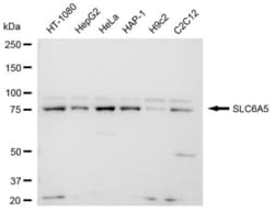 Invitrogen GlyT2 Recombinant Rabbit Monoclonal Antibody (23GB4145), Invitrogen