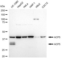 Invitrogen Tartrate Resistant Acid Phosphatase Recombinant Rabbit Monoclonal Antibody (23GB4280) 20 &mu;L | Buy Online | Invitrogen&trade; | Fisher Scientific