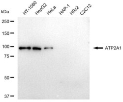 Invitrogen SERCA1 ATPase Recombinant Rabbit Monoclonal Antibody (23GB4340),