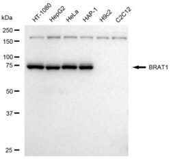Invitrogen BAAT1 Recombinant Rabbit Monoclonal Antibody (23GB4355), Invitrogen