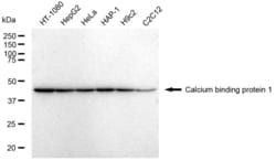 Invitrogen CABP1 Recombinant Rabbit Monoclonal Antibody (23GB4365), Invitrogen