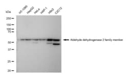 Invitrogen ALDH2 Recombinant Rabbit Monoclonal Antibody (23GB4810), Invitrogen