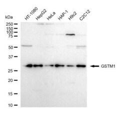 Invitrogen GSTM1 Recombinant Rabbit Monoclonal Antibody (23GB4940), Invitrogen