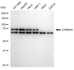 Invitrogen CHRNA4 Recombinant Rabbit Monoclonal Antibody (23GB5085), Invitrogen