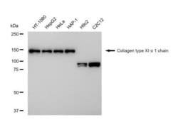 Invitrogen COL11A1 Recombinant Rabbit Monoclonal Antibody (23GB5100), Invitrogen