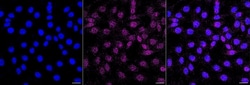 Invitrogen Dynamin 1 Recombinant Rabbit Monoclonal Antibody (23GB5165),