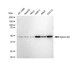 Invitrogen Ephrin B2 Recombinant Rabbit Monoclonal Antibody (23GB5270),